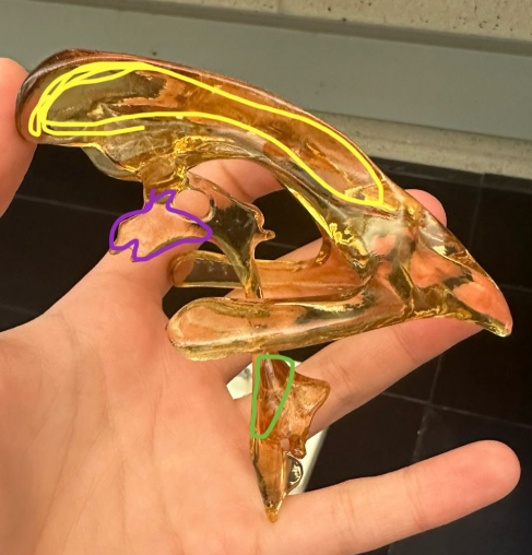 <p>What does the yellow circle indicate on the ventricle?</p>