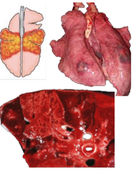 <p>What pattern of lung pathology? Describe appearance. Give example cause in pigs. </p>