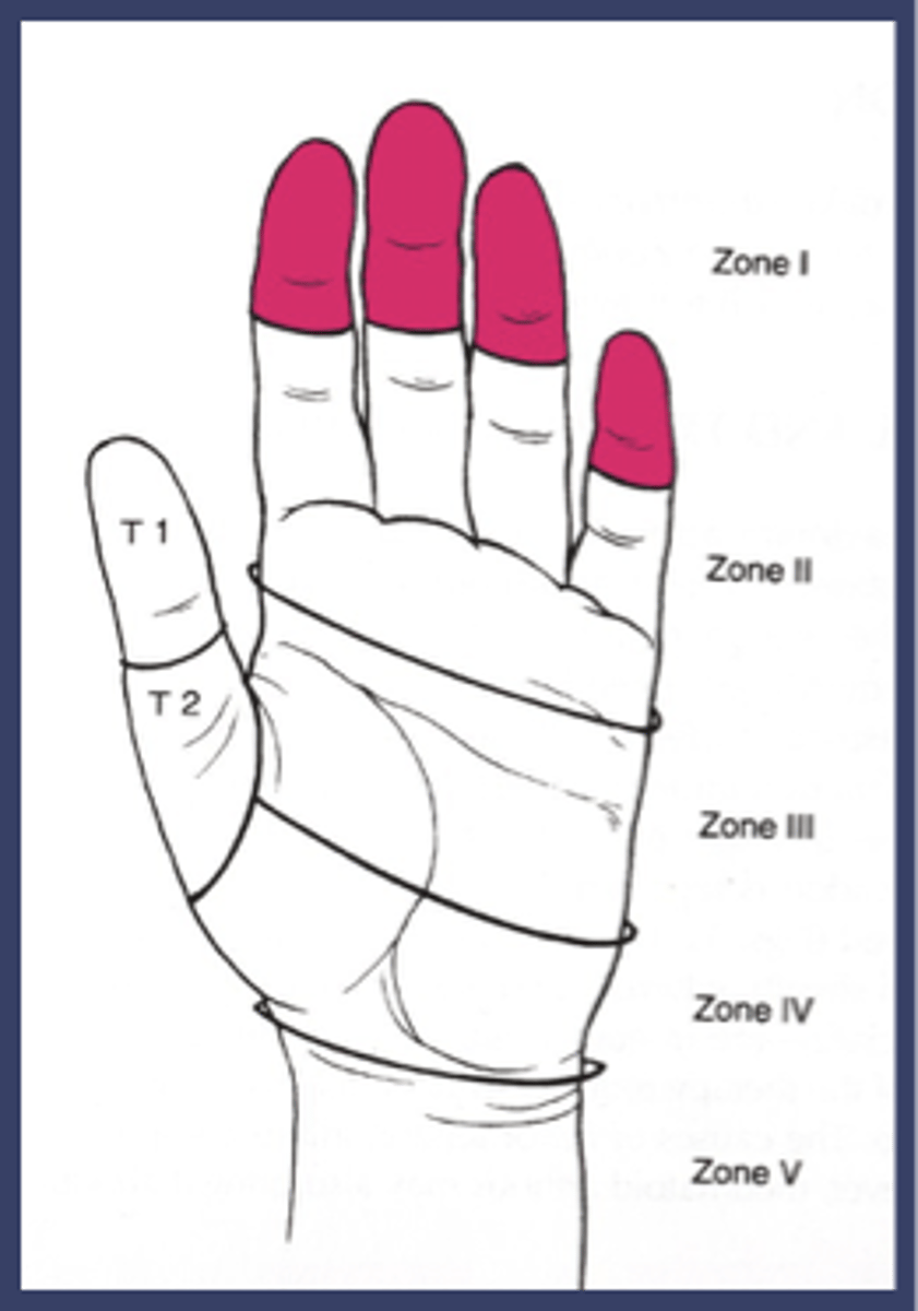 <p>FDP</p><p>Jersey finger</p>