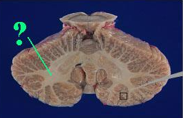 <p><span>Identify the indicated portion of the cerebellum.</span></p>