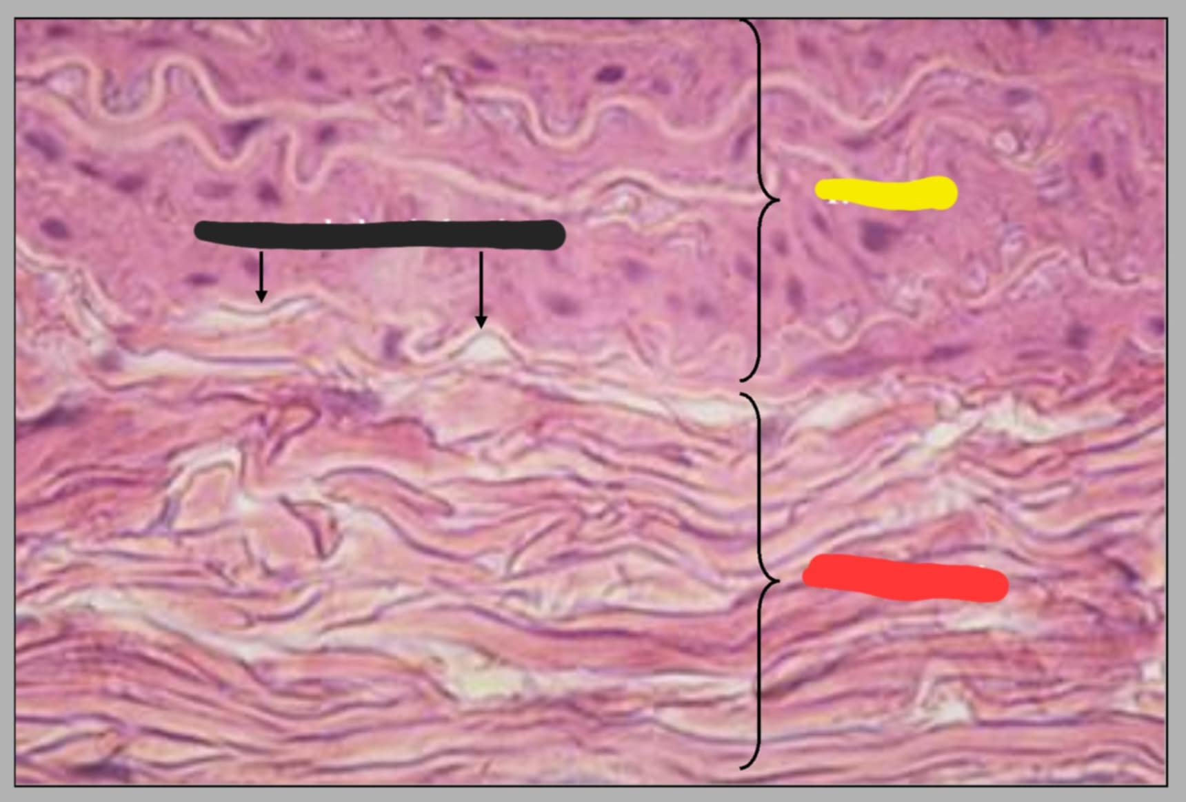 <p>State the parts of this slide.</p>