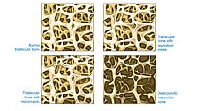 <p>What is a trabecula?</p>