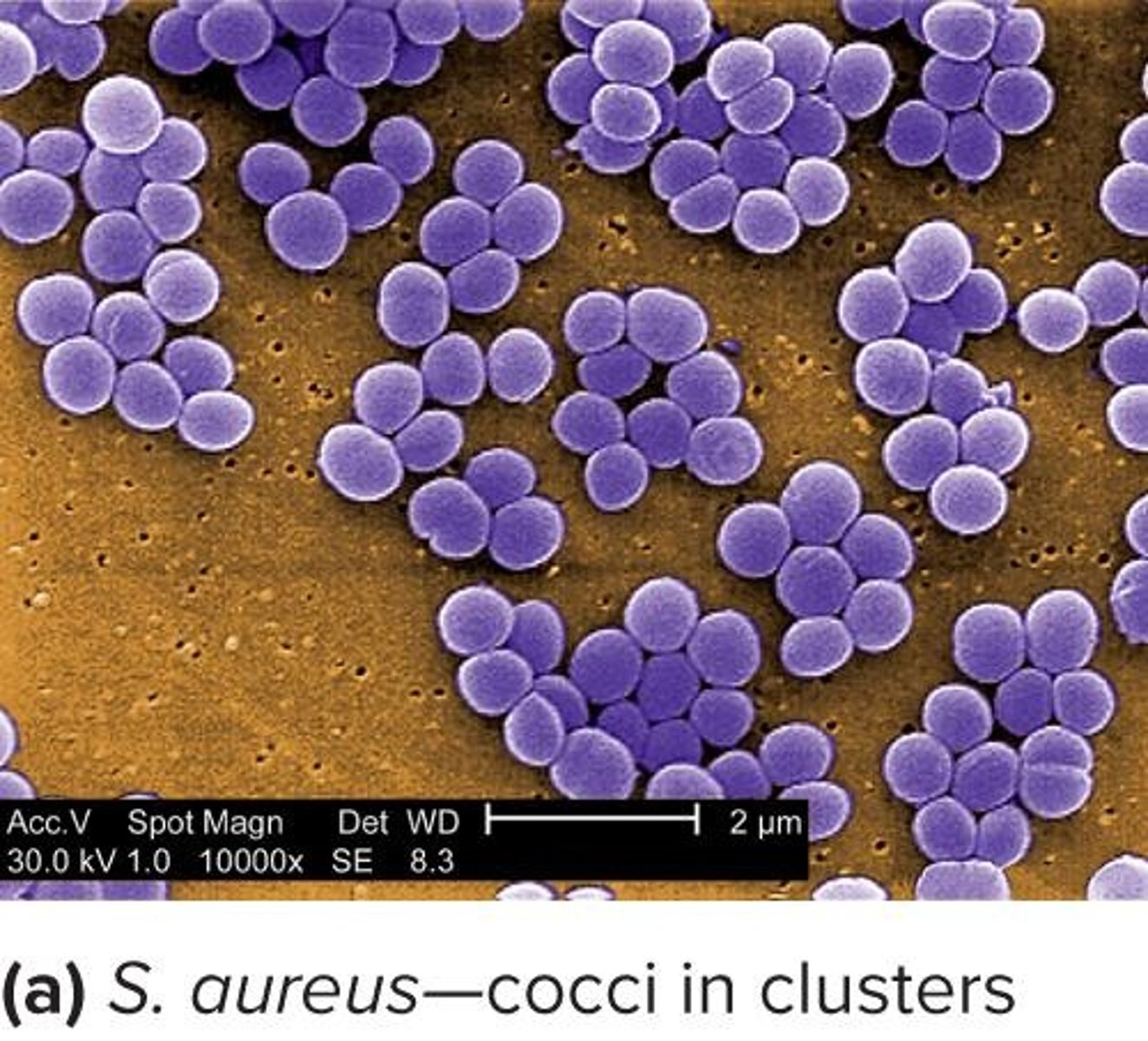 <p>grape-like clusters</p>