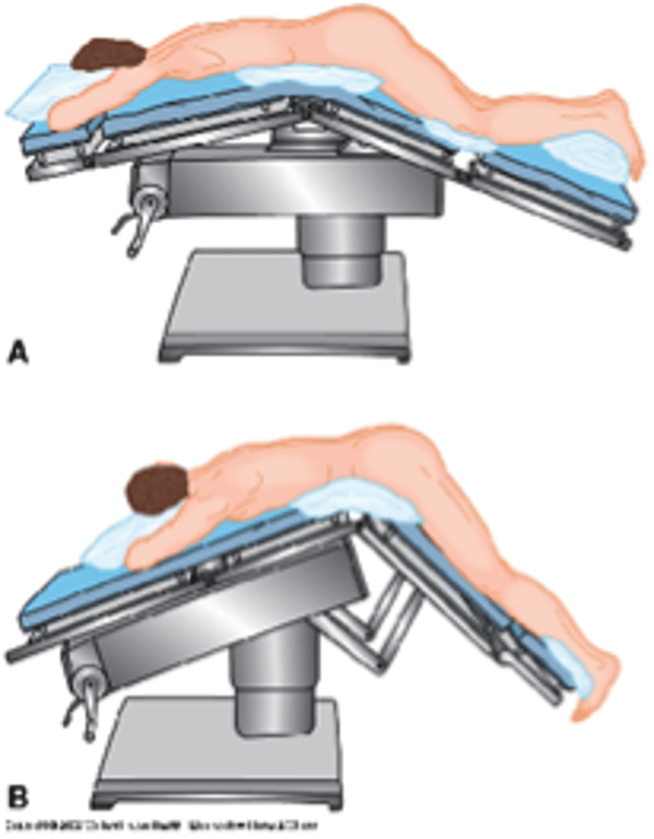 <p>lying over exam table that is lifted in the middle</p><p>-rectal exams or instrumentation (flexible sigmoidoscopy)</p>