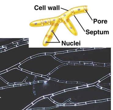 <p>Walled hyphae</p>