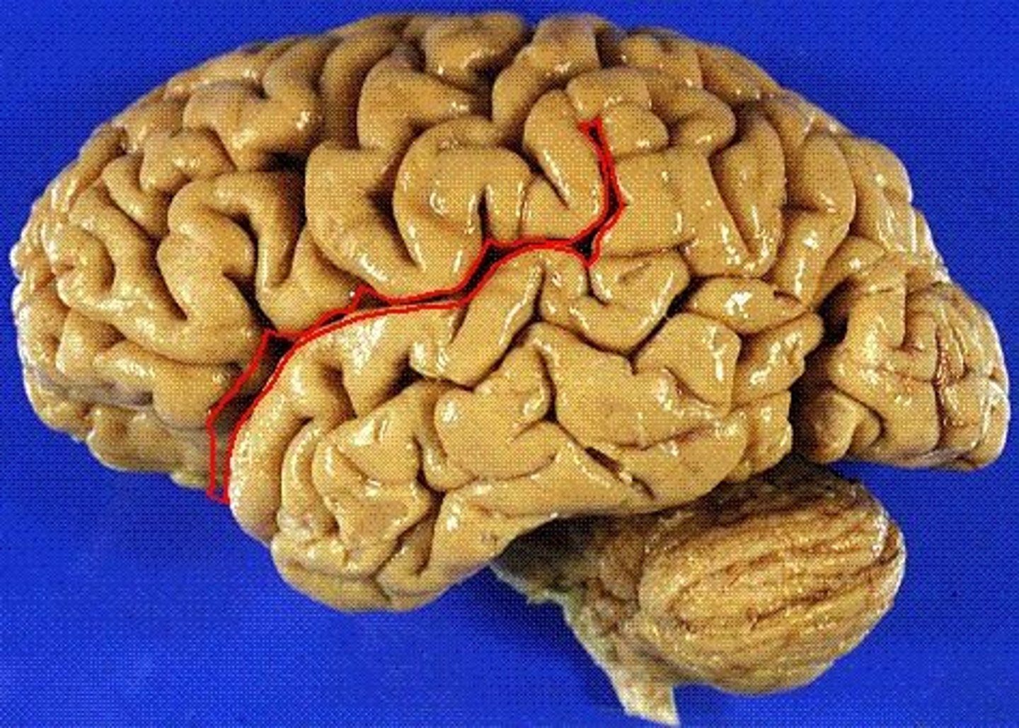 <p>separates temporal lobe from frontal and parietal lobes</p>