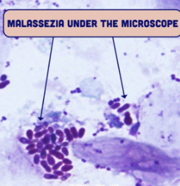 <p>§ Normal flora (low levels)</p><p>§ Lipophilic: feeds on skin lipids</p><ul><li><p>Production by sebocytes and keratinocytes</p></li></ul><p>§ Sebum: moisturize and protect skin and hair </p><ul><li><p>Protective barrier</p></li><li><p>Prevents water loss</p></li><li><p>Shields against microbes (some), friction, UV radiation</p></li></ul><p>§ Stratum corneum only</p><ul><li><p>Scalp, face, chest, and back</p></li></ul><p></p>