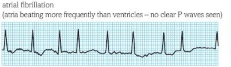 <p>What does this trace show ? </p>