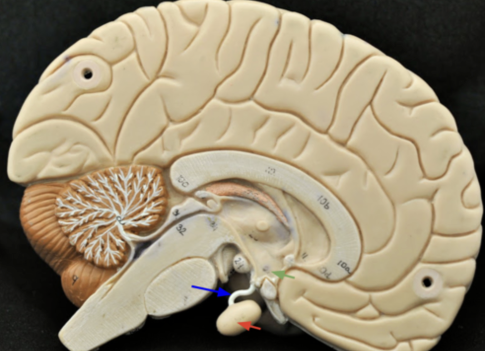 <p>Blue arrow points to</p>