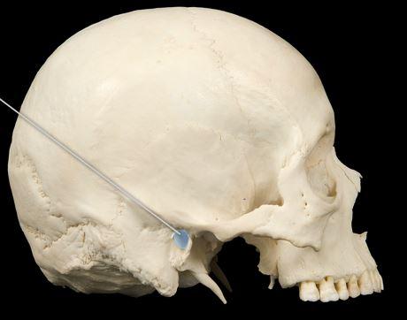 <p>external acoustic meatus</p>