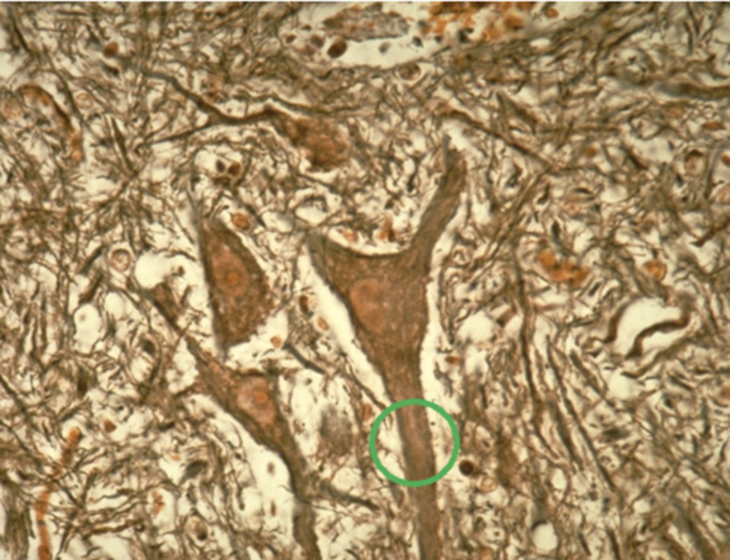 <p>Which of the four major tissue types is presented in the following image of the spinal cord:</p>