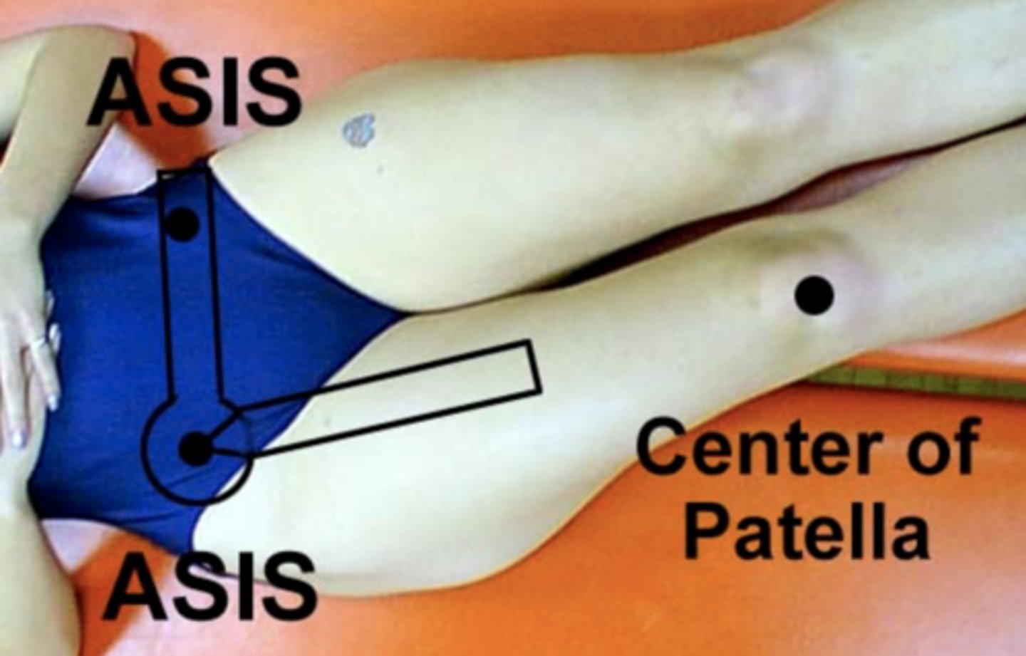 <p><span class="bgP">Fulcrum</span>: <strong><em>ASIS </em></strong>of extremity being measure</p><p><span class="bgB">Proximal arm</span>: imaginary horizontal line connecting the <strong><em>two ASIS</em></strong></p><p><span class="bgY">Distal arm</span>: anterior midline of the femur using <strong><em>midline of patella</em> </strong>for reference</p>