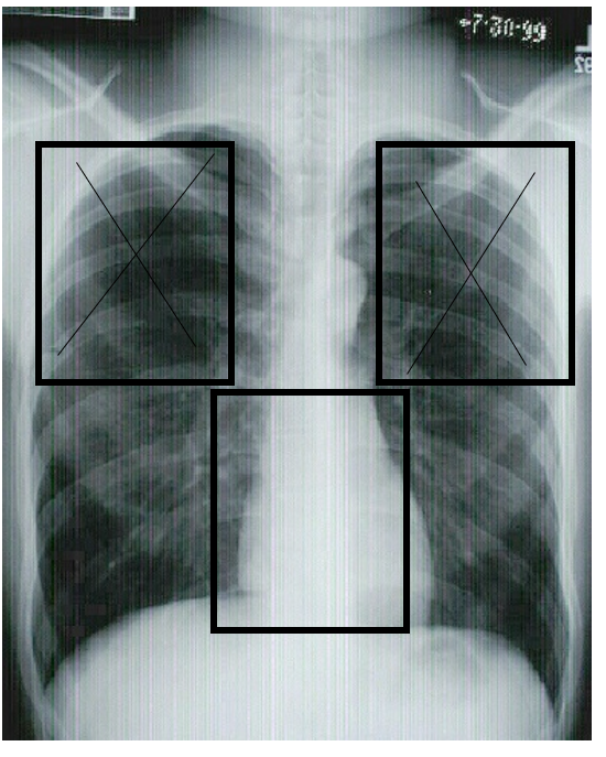term image