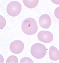 <p>Dr. Vicente Y. Belizario Jr.</p>