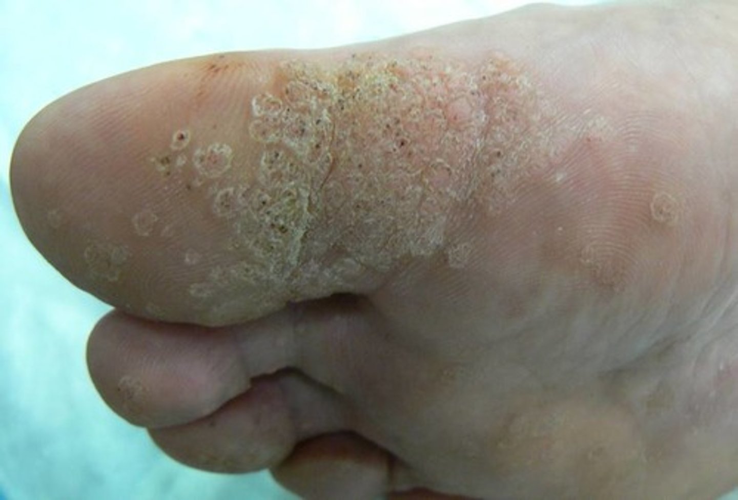 <p>many, form patterns</p>