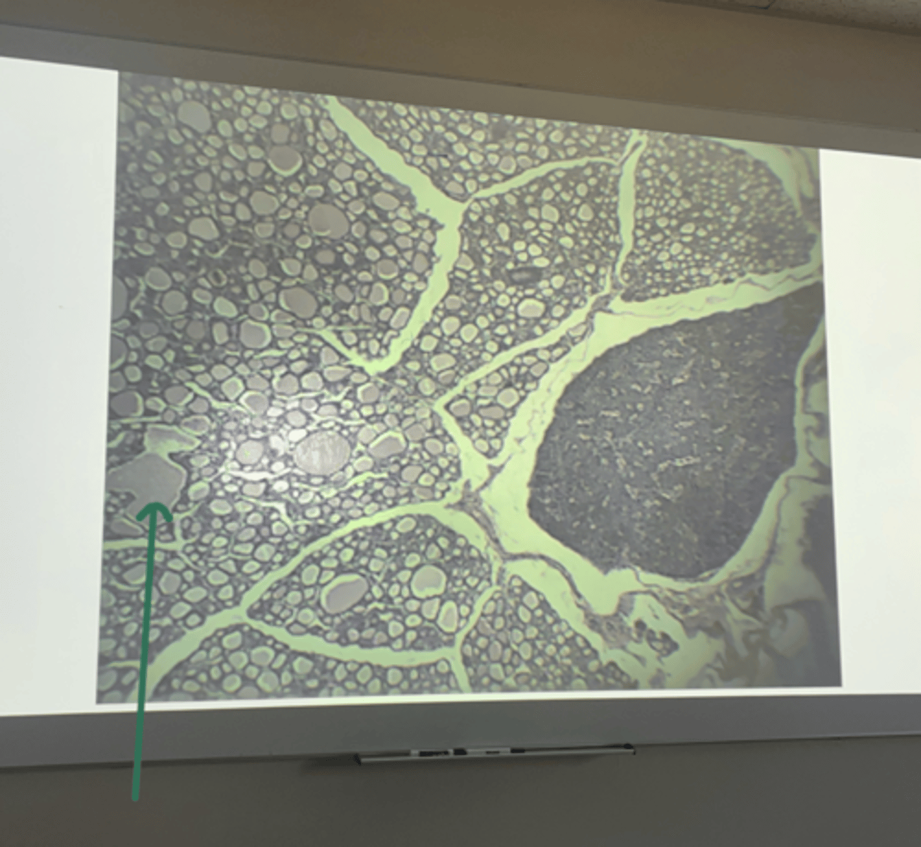 <p>gland and structure</p>