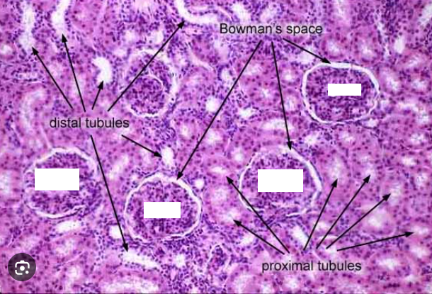 <p>Bowmen’s capsule <u>lumen</u>, PCT, glomerulus, DCT</p>