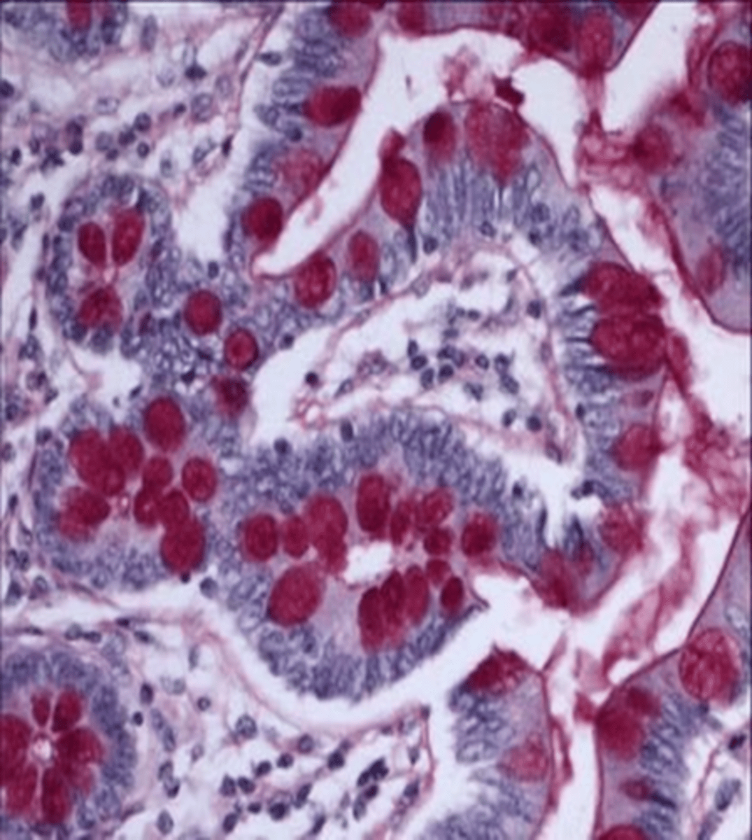 <p>polysaccharides; glycogen storage disease or fungal hyphae/yeast</p><p>1 multiple choice option</p>