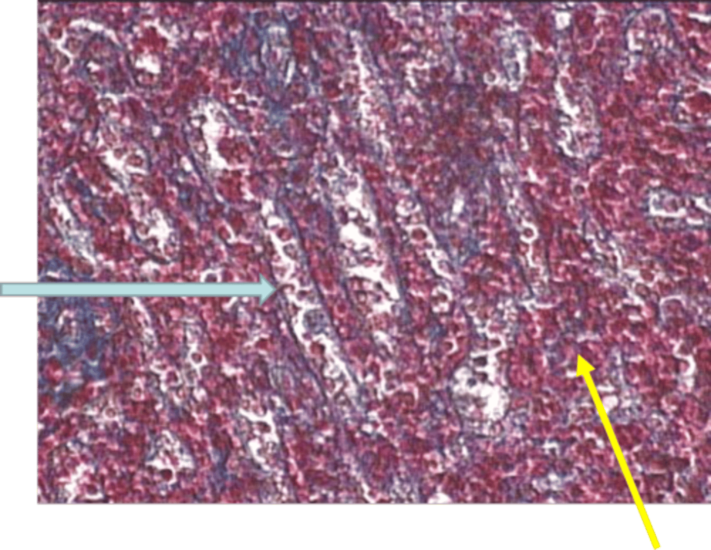 <p>blue arrow sinusoidal capillary</p>