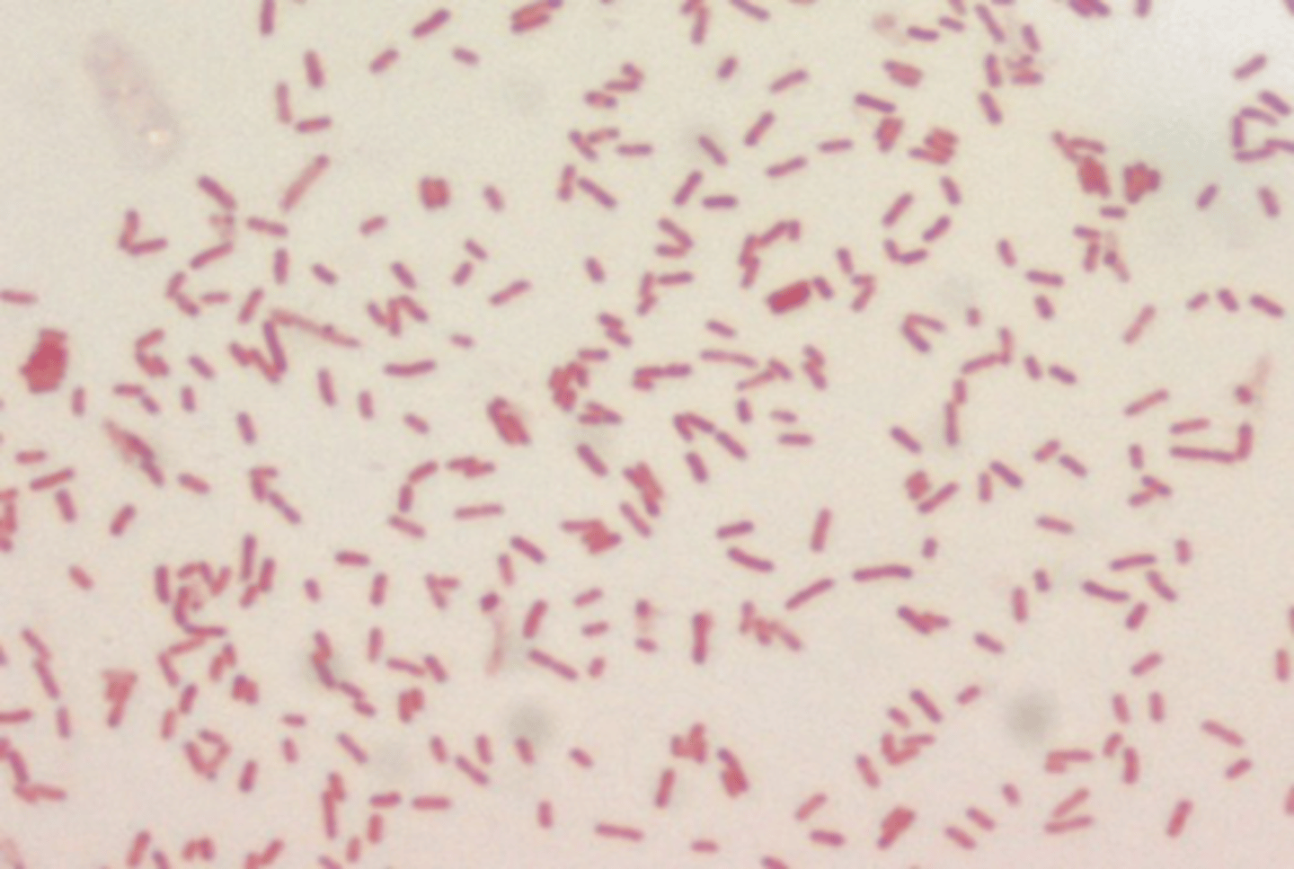 <p>Gram negative coccobacili</p>