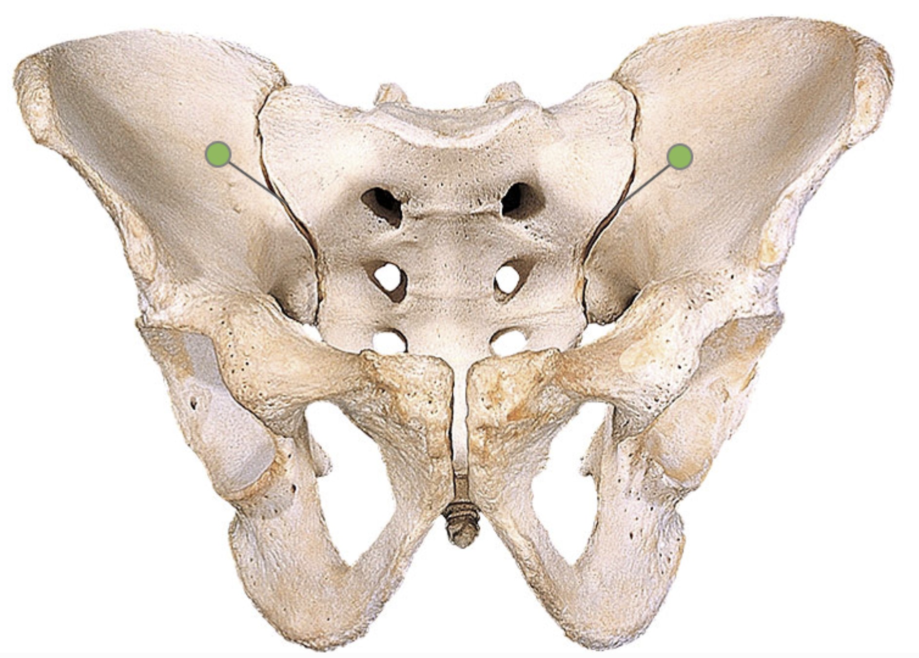 <p>Which bone landmark of the pelvic girdle is a ridge that border the sacrum?</p>