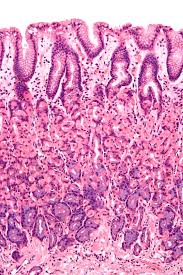 <p>Found in digestive system small and large intestines , can have mircovilii which is like finger that helps increase surface area to make absorbing nutrients more efficient </p>