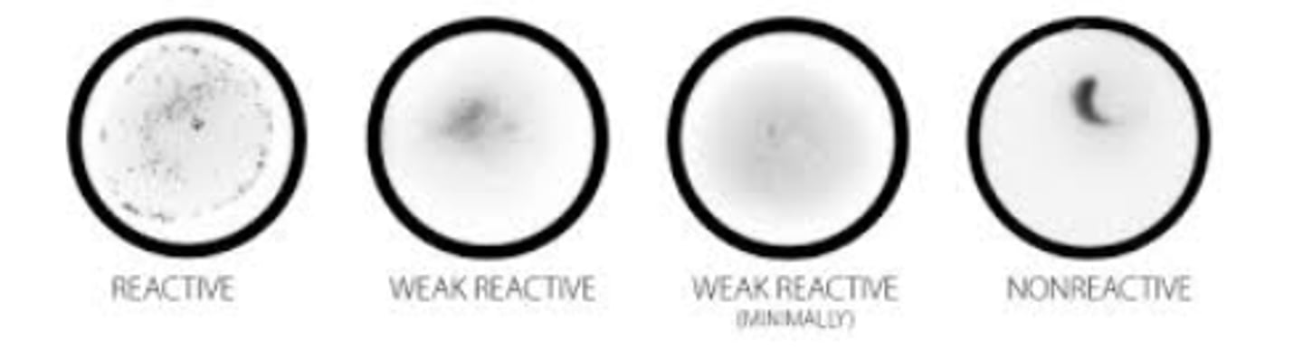 <p>VDRL or RPR (Non-treponemal tests)</p><p>Precipitate of fine particles that is microscopic (VDRL) or macroscopic (RPR-uses charcoal)</p><p>Reactive = med to large clumps</p><p>Weak Reactive = small clumps</p><p>Nonreactive = no clumps; tail when swirling</p>