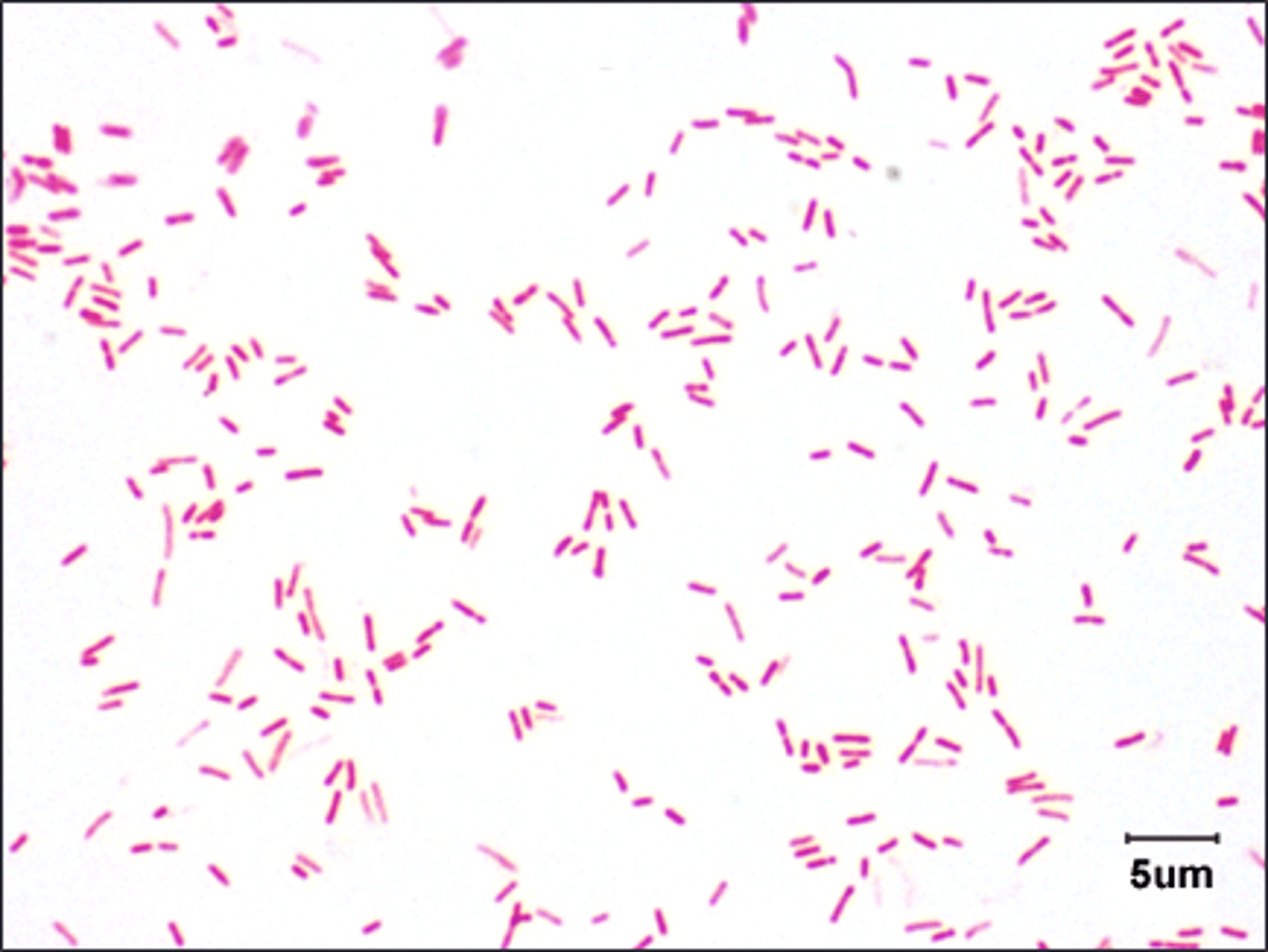 <p>This is gram negative</p>