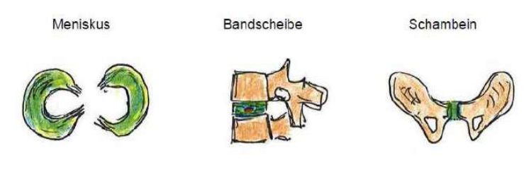 <p>Meniskus, Bandscheibe, Schambein</p>