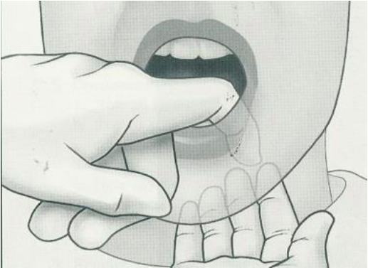 <p>Uses both hands on the same structure (one inside, one outside)</p><p>checks the floor of the mouth</p>