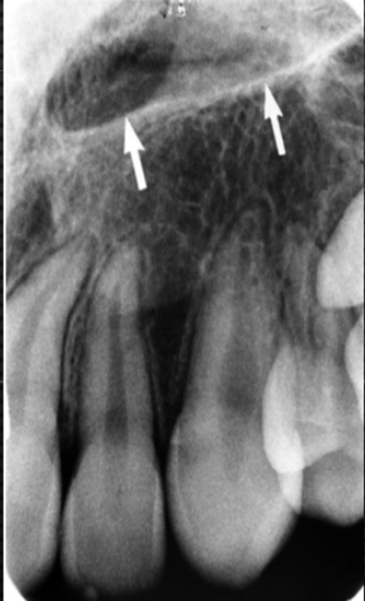 <p>Identify the structure</p>