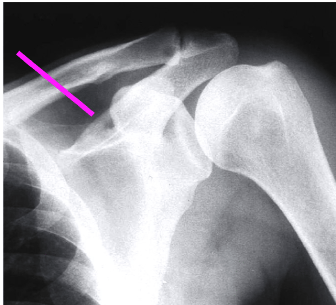 <p>what does the pink line point to?</p>