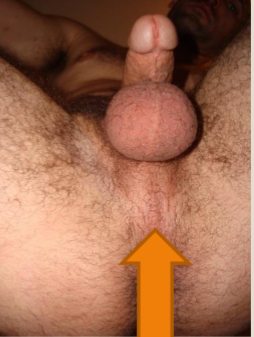 <p>Perineum (taint)</p>