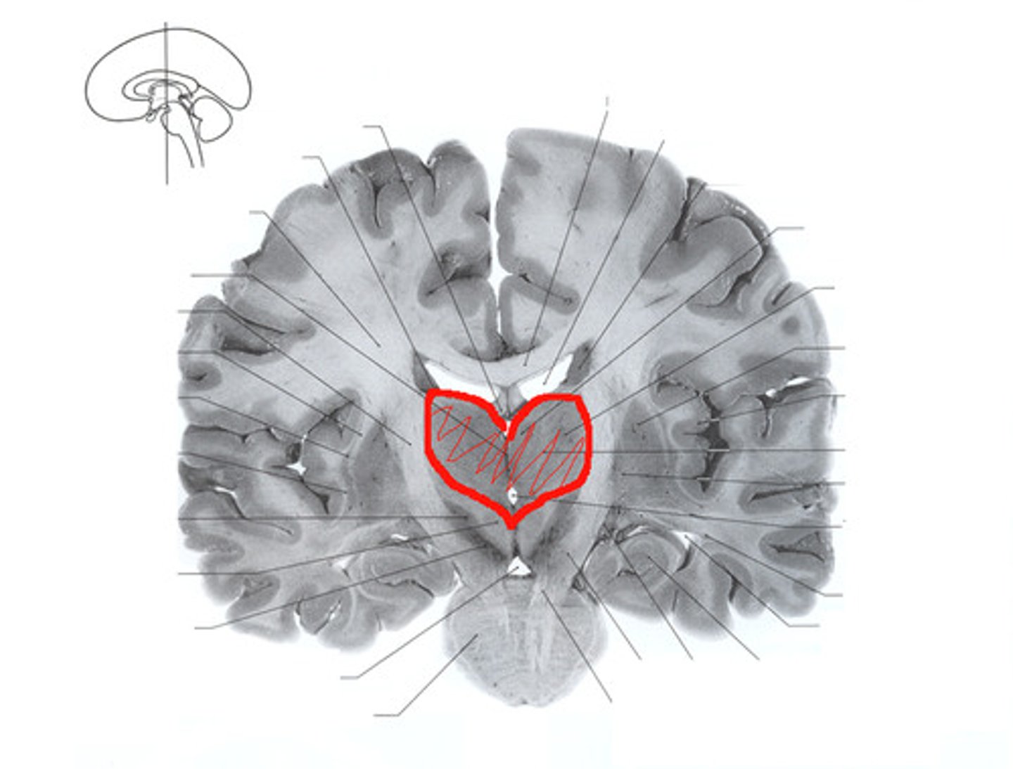<p>heart shaped, deep in the brain, hugs the third ventricle. Referred to as the relay center.</p>