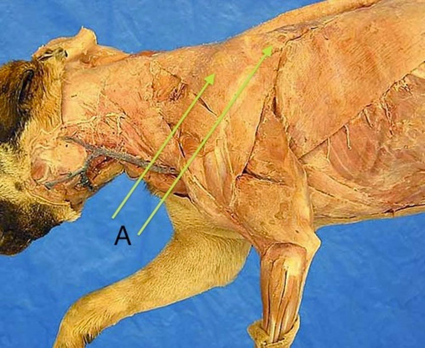 <p>What muscle is this (bottom arrow?</p><p>Origin?</p><p>Insertion?</p><p>Function?</p><p>Innervation?</p><p>What larger muscle is this part of?</p>