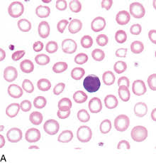 <p>What are these cells exhibiting</p>