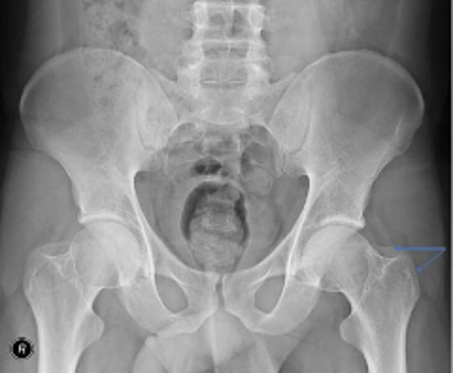 <p>What are the arrows pointing to?</p>