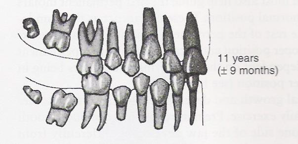 <p>Permanent 3rd molars</p>