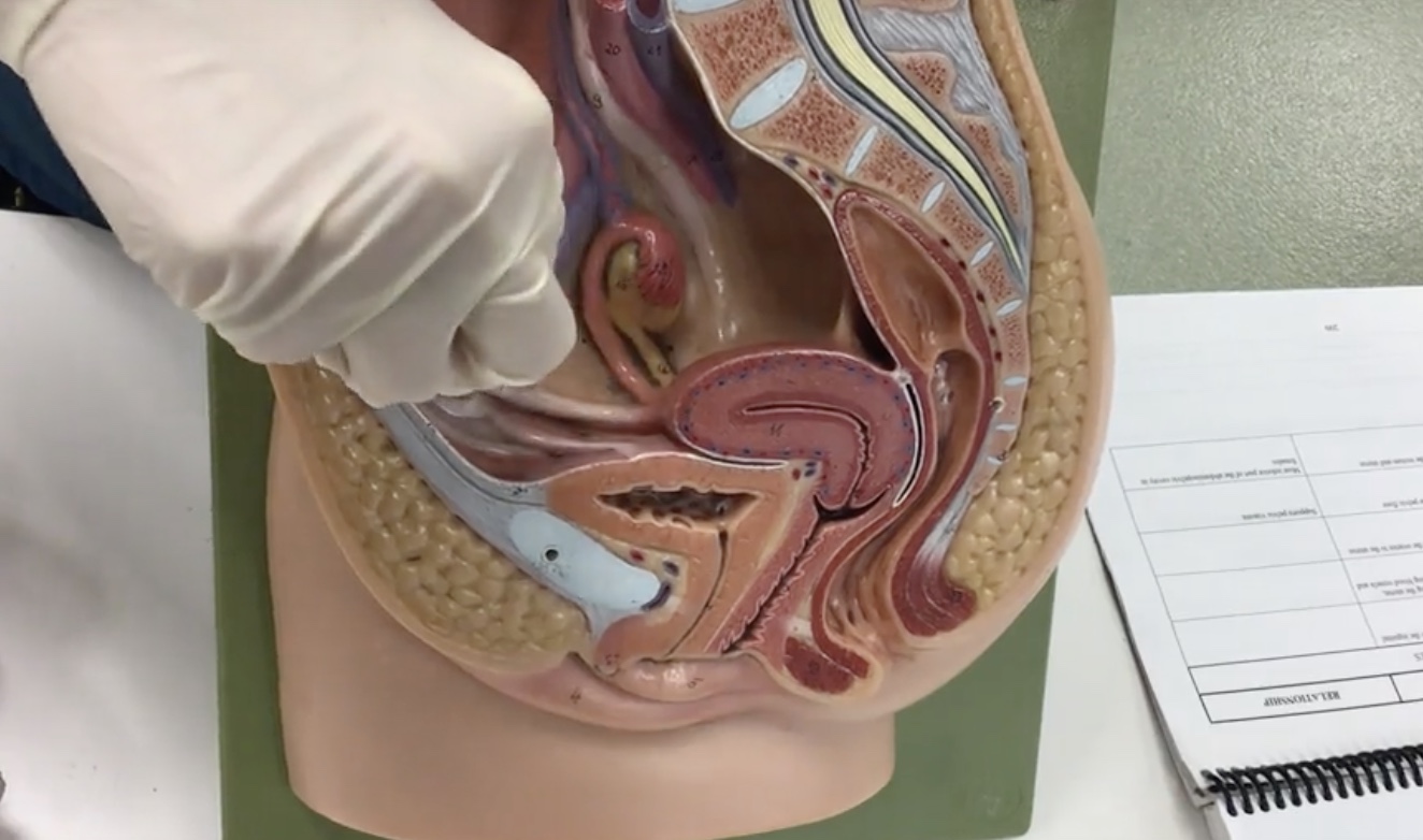 <p>Description: Double layer of peritoneum covering the uterus, uterine tubes, and ovaries containing blood vessels and nerves to the uterus</p><p>Relationship: N/A</p>