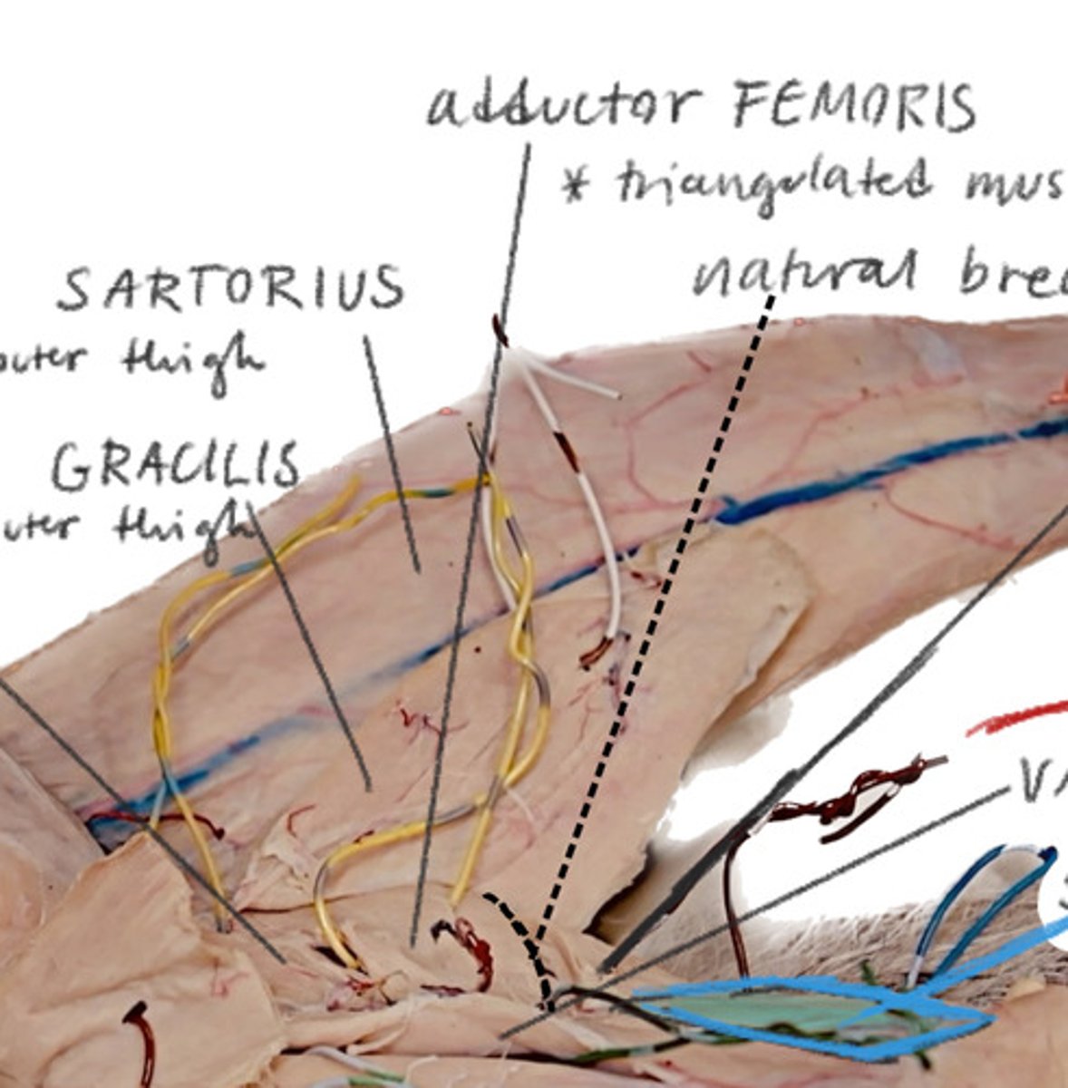 <p>BENEATH GRACILLIS after the adductor longus Middle</p>