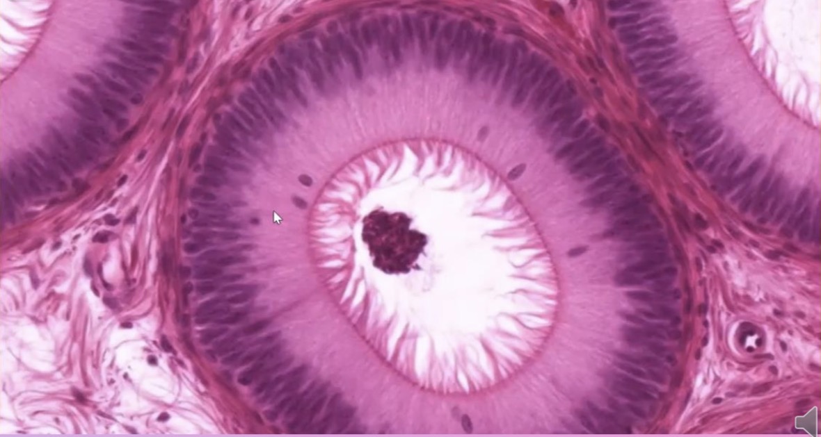 <p>Epitelio pseudoestratificado cilíndrico con microvellosidades largas</p>