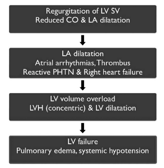 <ul><li><p>Chronic MR causes gradual dilatation of LA (little increase in pressure and few symptoms). LV dilates slowly and LV diastolic and LA pressures gradually increase due to chronic volume overload of LV.</p></li><li><p>Acute MR causes rapid rise in LA pressure (as LA compliance is normal) and marked symptomatic deterioration</p></li></ul><p>Mitral valve prolapse</p><ul><li><p>Common cause of mild MR</p></li><li><p>Due to developmental abnormality of mitral valve or degenerative myxomatous change in normal mitral valve</p></li><li><p>May be associated with Marfan syndrome</p></li><li><p>Mild: valve remains competent but bulges back into LA during systole, causing mid-systolic click (not always audible) but no murmur</p></li><li><p>Regurgitant valve: click is followed by late systolic murmur (lengthens as severity increases)</p></li><li><p>Progressive elongation of chordae tendineae leads to increasing MR and if chordal rupture occurs, severity increases swiftly (rare before 5th or 6th decade)</p></li><li><p>Associated with arrhythmias, atypical chest pain and small risk of embolic stroke or transient ischaemic attack</p></li></ul><p>Other causes</p><ul><li><p>Dilatation of LV distorts geometry of chordae tendineae and their papillary muscles</p></li><li><p>Dilated cardiomyopathy and heart faliure from CAD are common causes of functional MR</p></li><li><p>Endocarditis causes acute MR</p></li></ul><p></p>