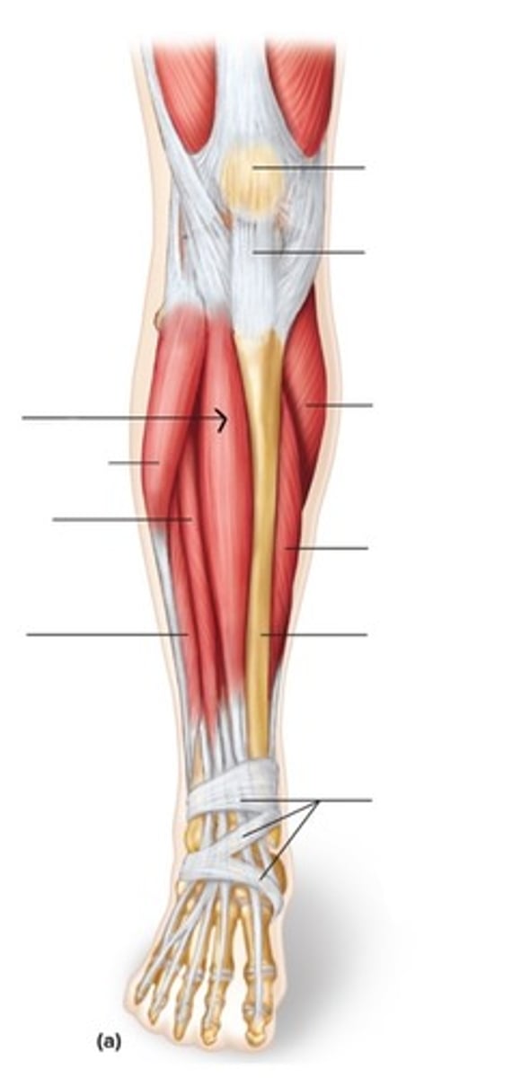 <p>What muscle is this?</p>