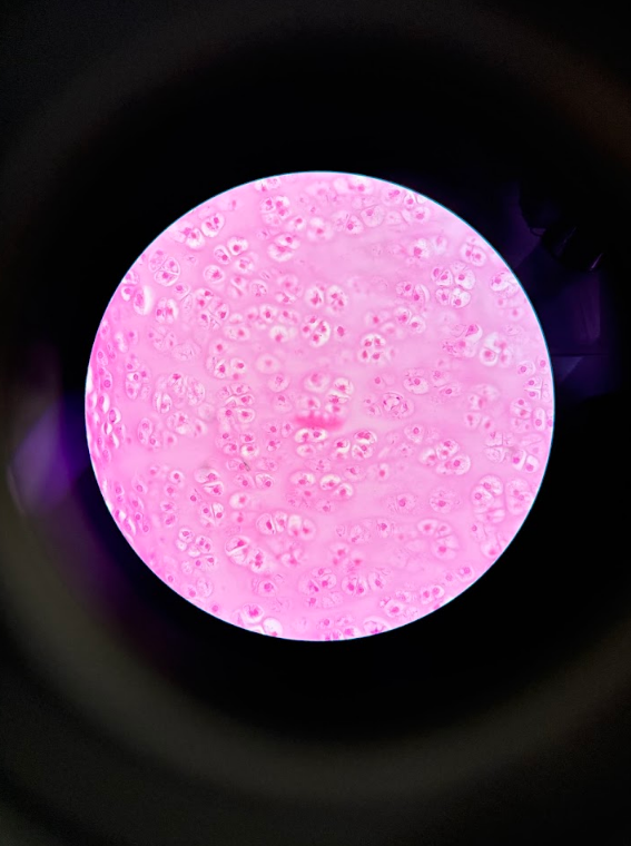 <p>thin strip with many circles/holes</p><ul><li><p>Chondrocyte = dark “cell-like” shape inside lacuna </p></li><li><p>Lacuna = small little “ball-like” structures w/dark spots inside</p></li><li><p>Matrix = empty space surrounding lacuna</p></li></ul><p></p>