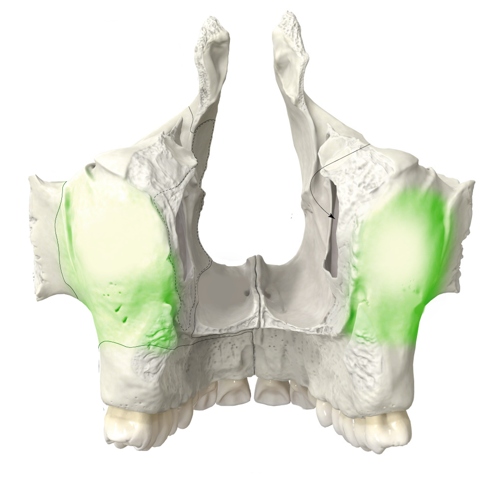 <p>halántékcsont alatti felszín</p>