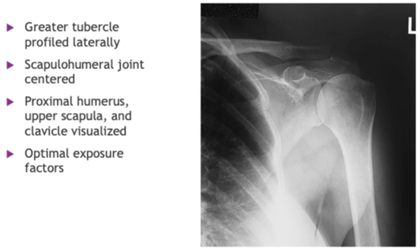 <p>- Epicondyles parallel</p><p>- CR 1 inch (2.5 cm) inferior to coracoid process</p><p>- Greater tubercle profiled laterally</p><p>- Scapulohumeral joint centered</p><p>- Proximal humerus, upper scapula, and clavicle visualized</p><p>- Optimal exposure factors</p>