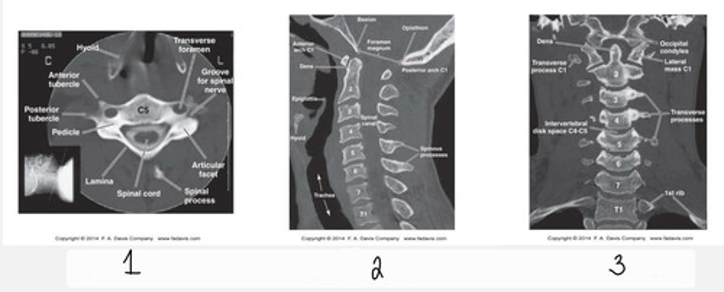 <p>What type of CT view does 1 show?</p>
