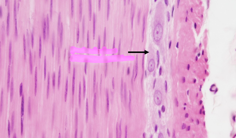 <p>the arrow points to</p>