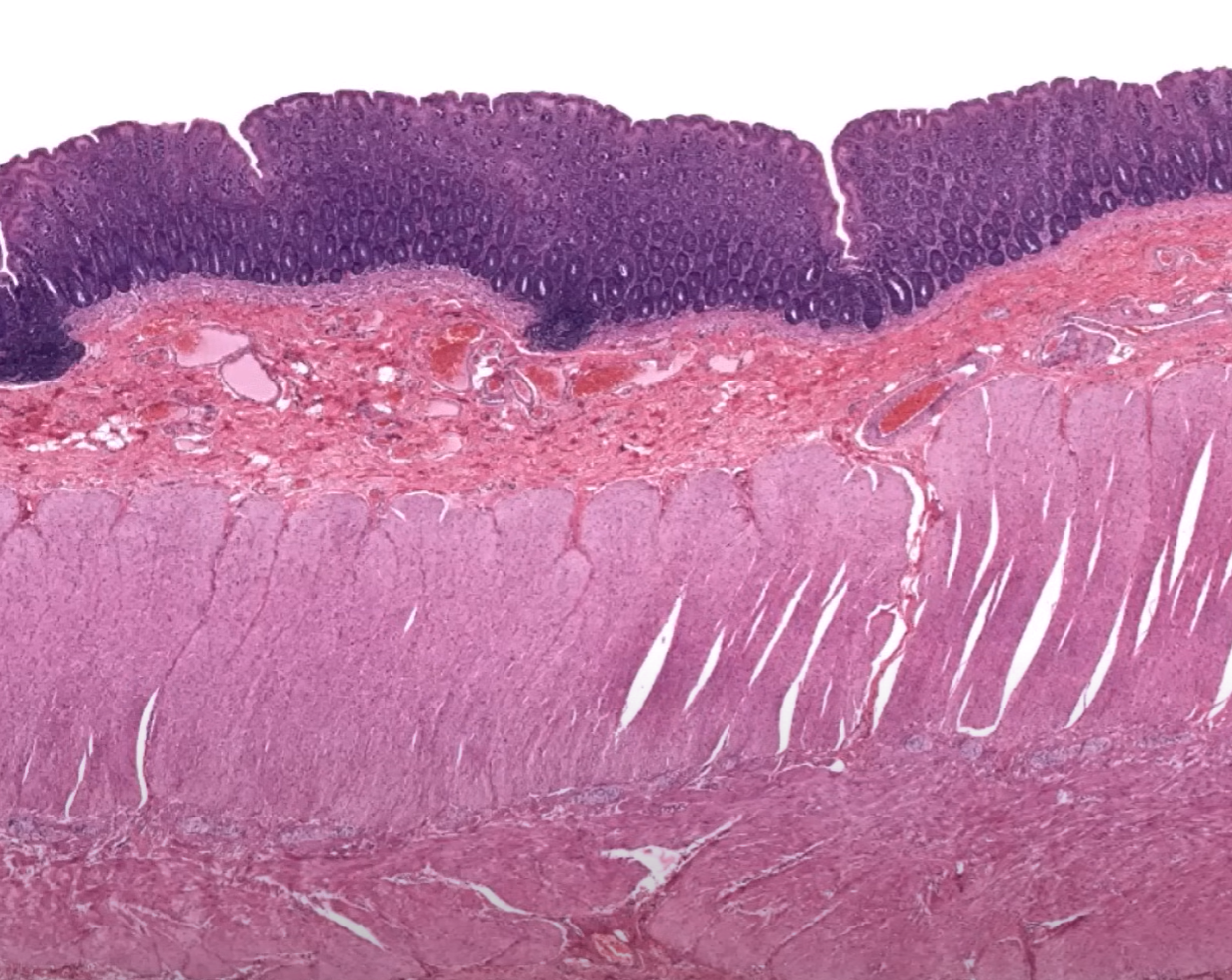 <p>Organ?</p><p>Label?</p><p>Structure between muscular layers?</p>