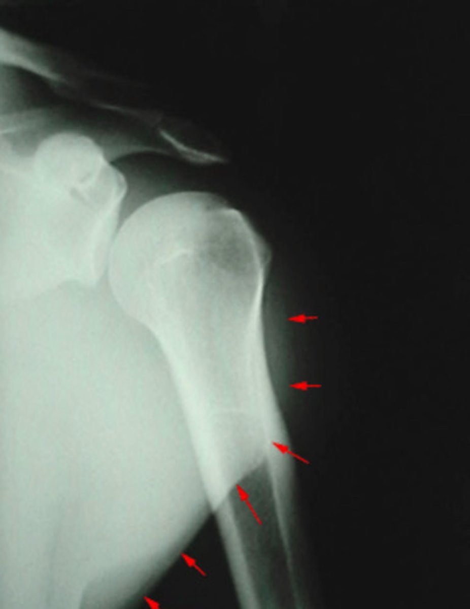 <p>What is being pointed out by the arrows in this image?</p>